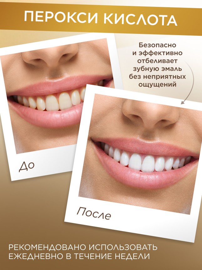 Фото Отбеливающие полоски для зубов