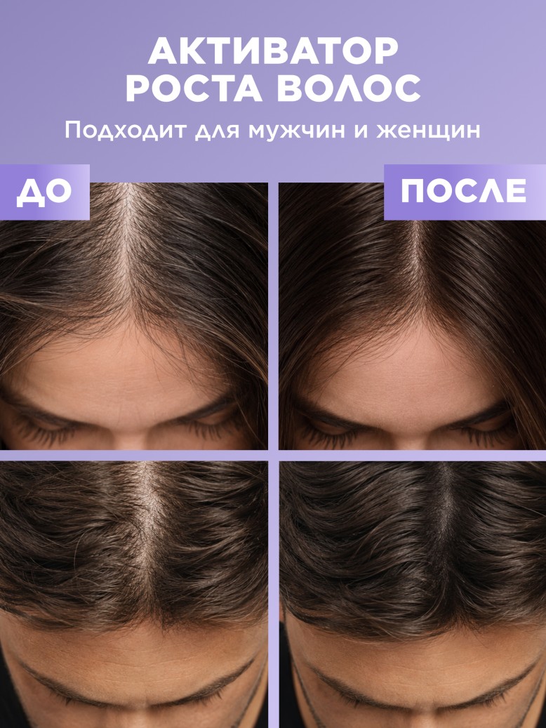 Заказать Масло для волос «Густота и рост» Botanica