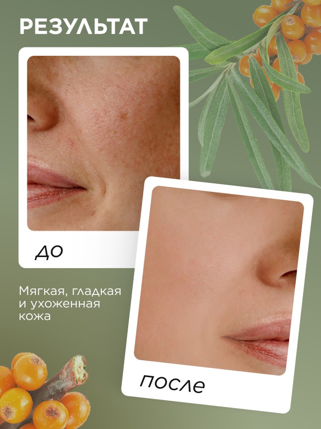 Заказать Крем универсальный для лица, рук и тела Omegahit