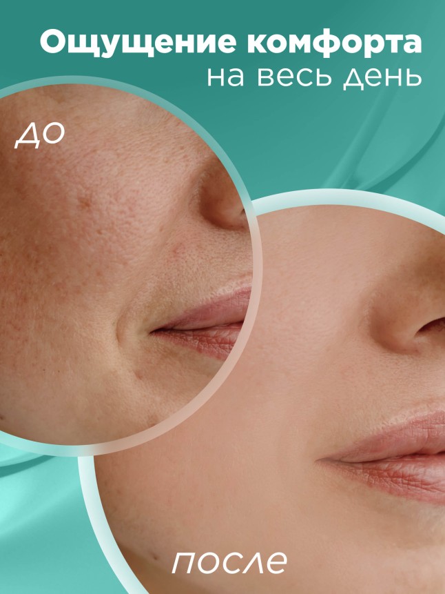 Заказать Гиалуроновый увлажняющий дневной крем для лица HyaluronCa