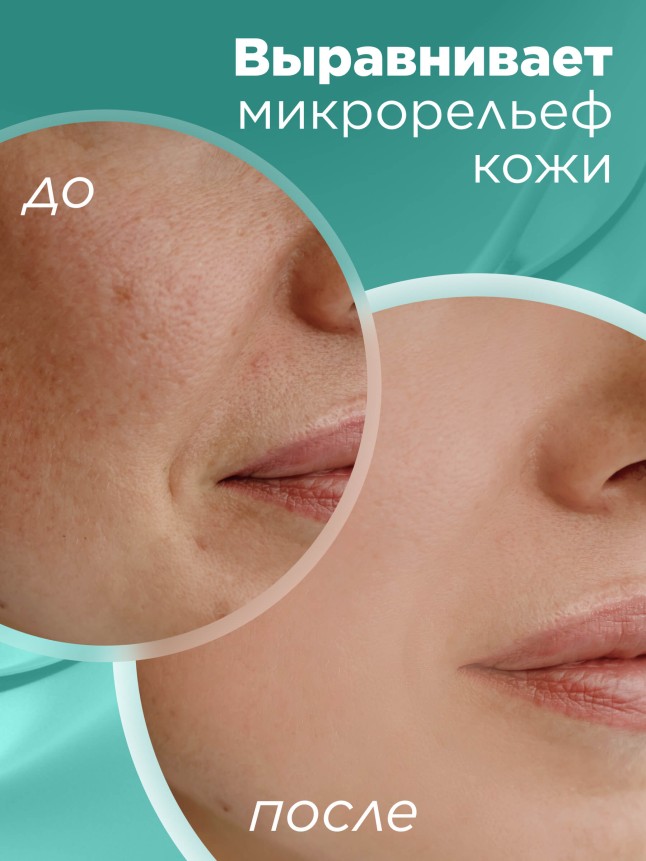 Заказать Гиалуроновая пилинг-скатка для лица HyaluronCa