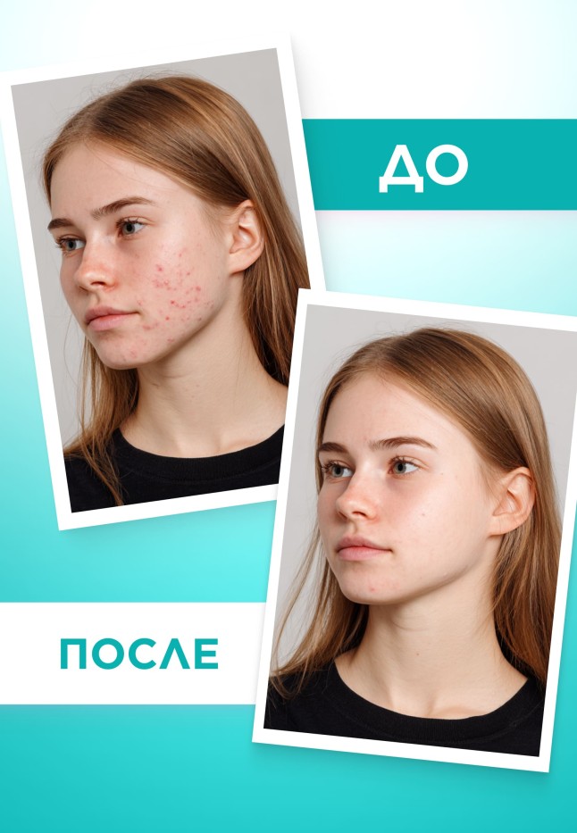 Заказать Гель для глубокого очищения кожи TeenSkin