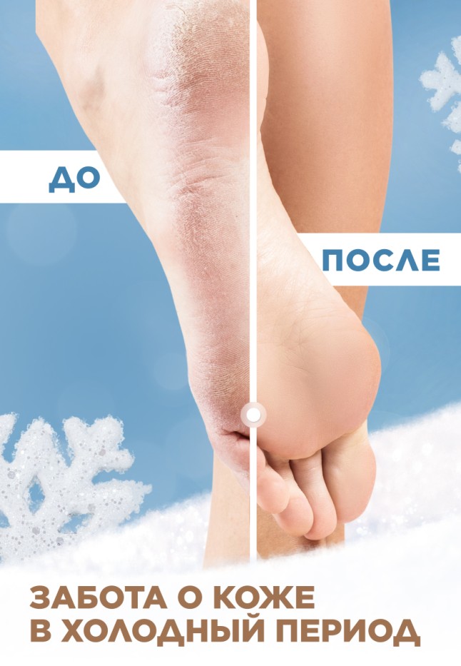 Заказать Крем для ног против зимней стужи Zima