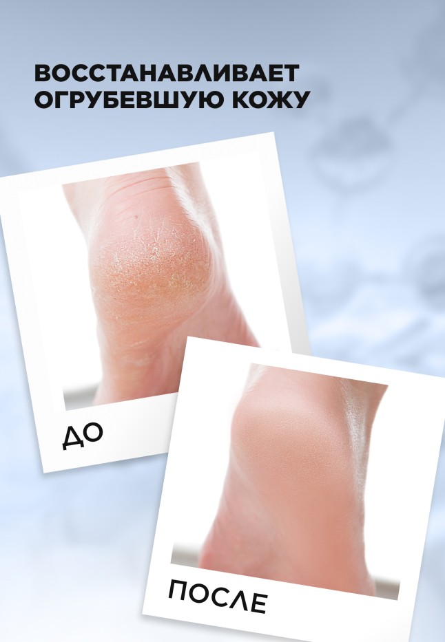 Заказать Крем-воск для очень сухих участков кожи Expert Pharma