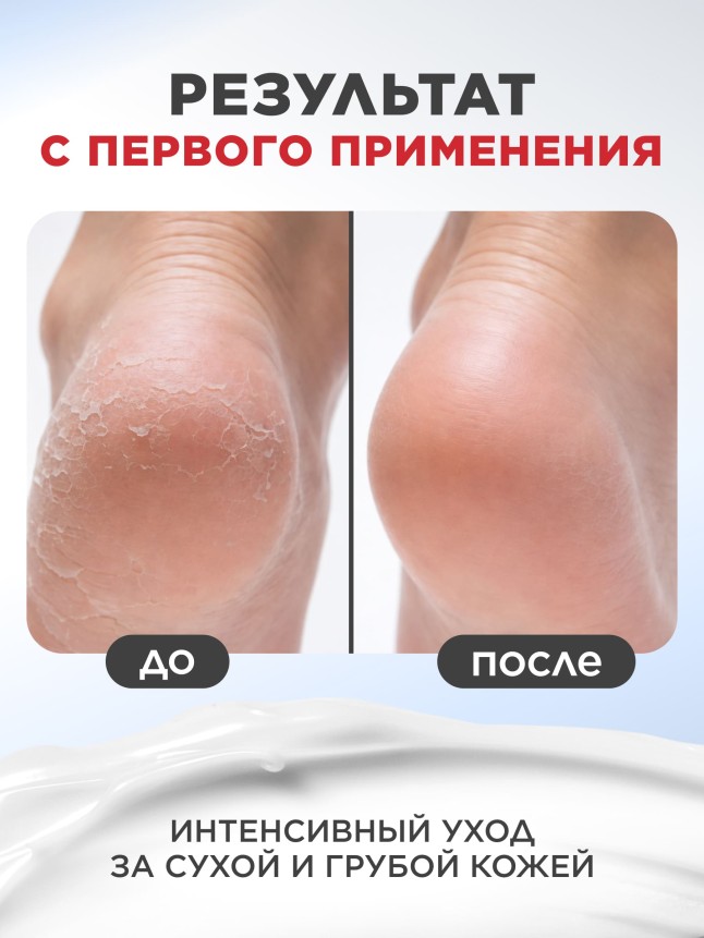 Купить Активный крем для ног с мочевиной 35% Expert Pharma