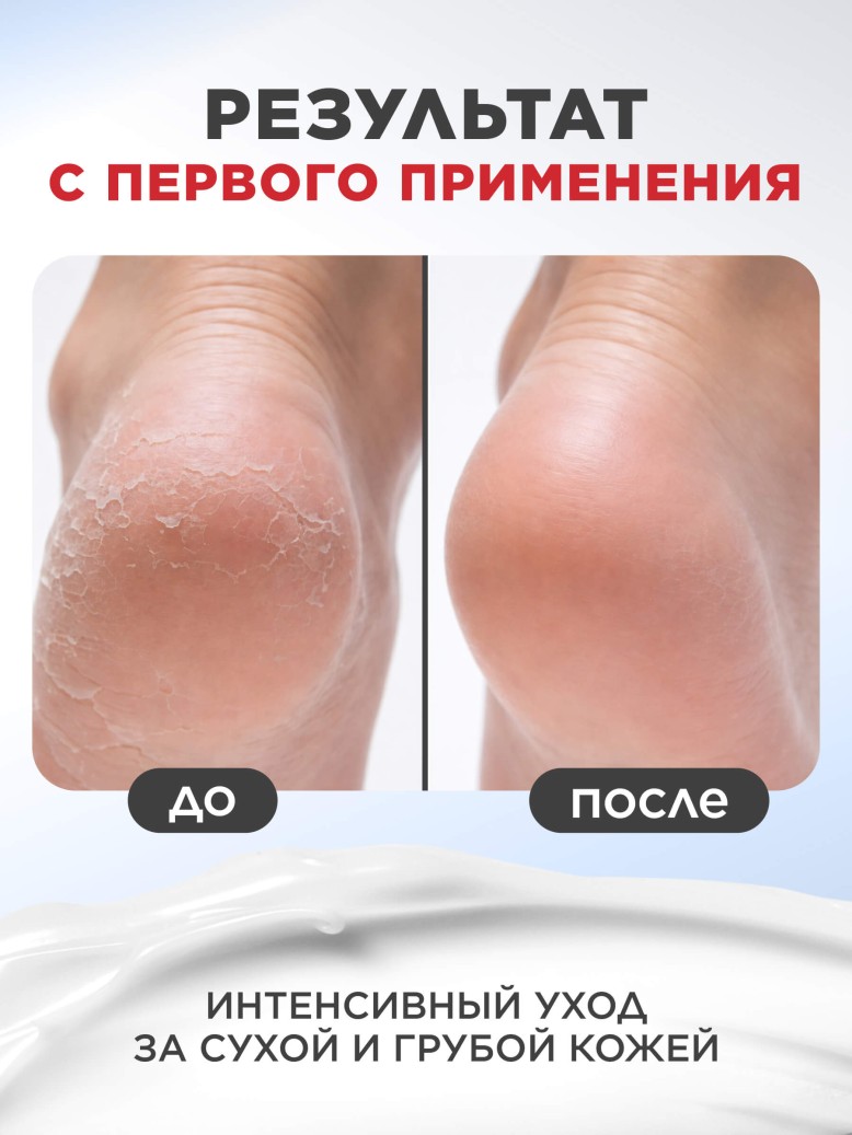 Купить Активный крем для ног с мочевиной 35% Expert Pharma