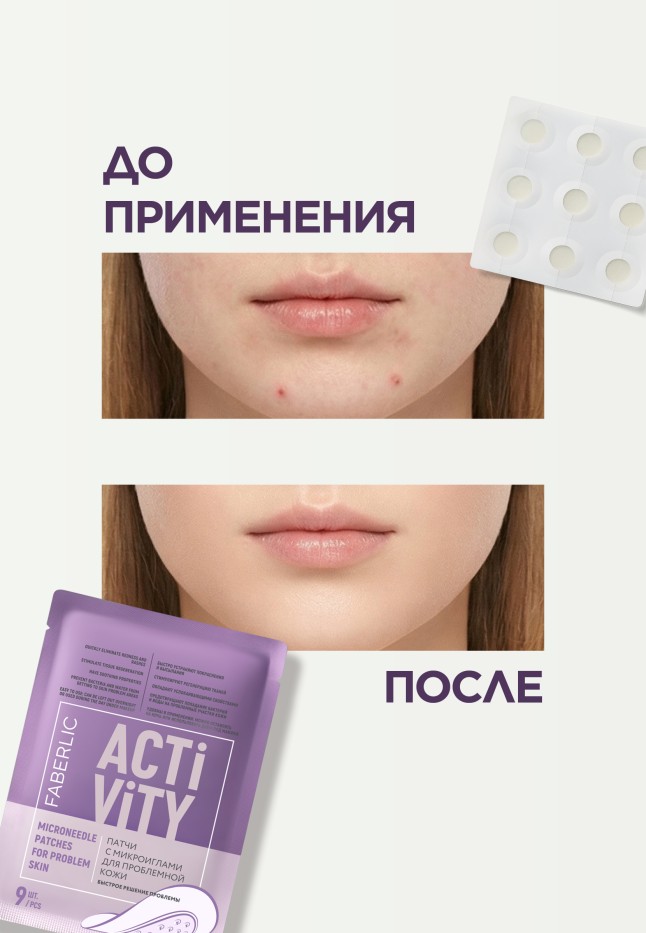 В Беларуси Патчи с микроиглами для проблемной кожи